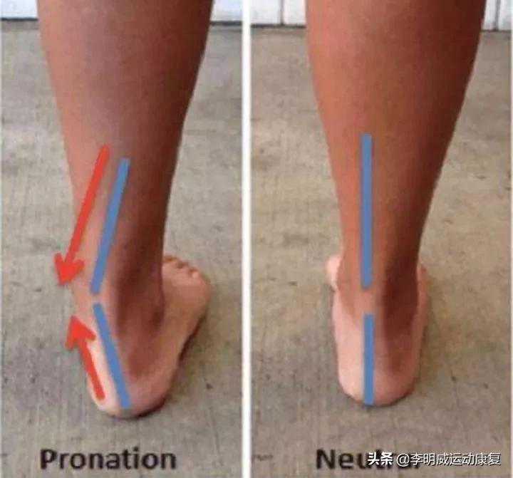 如何纠正宝宝不吃母乳,如何纠正足外翻的跑步姿势