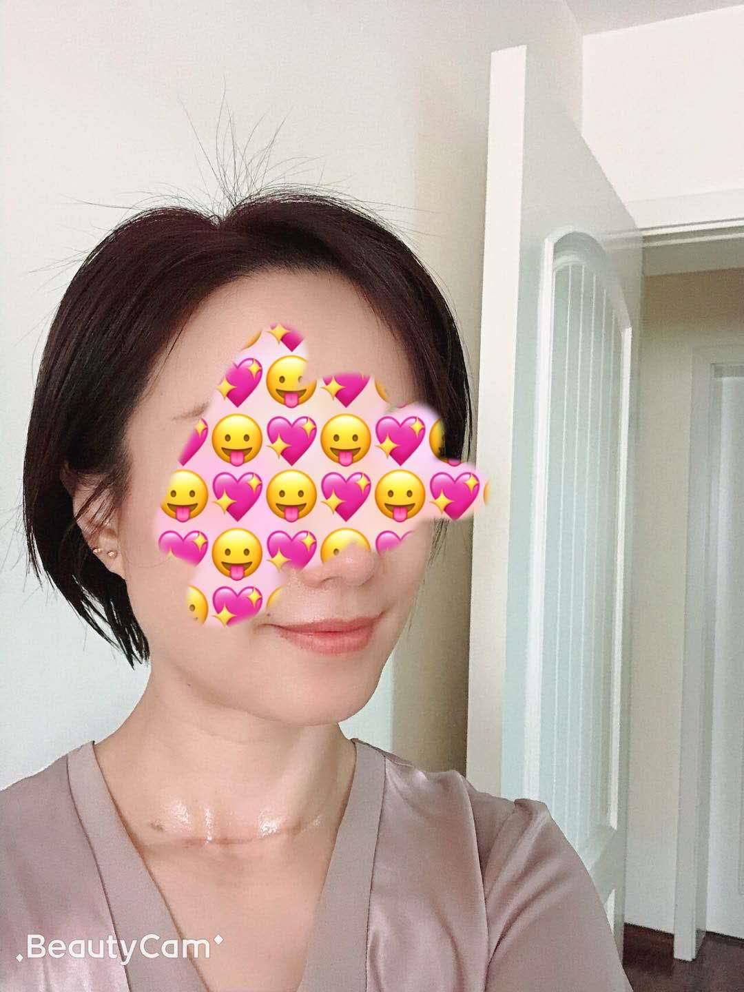 甲状腺问题和教师职业有关吗,甲状腺是老师的职业病吗