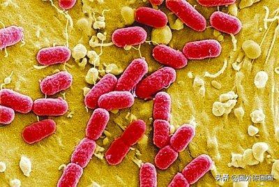 生活中有哪些常见凶险的致病菌,防控病原菌受到污染的措施主要有