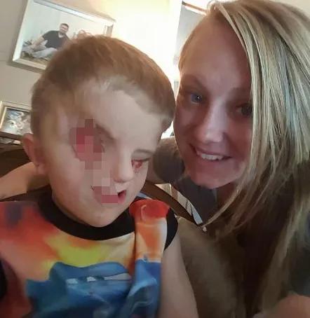 我有梅毒，与弱智女子连生9个娃：被遗传病支配的家庭，我不忍看