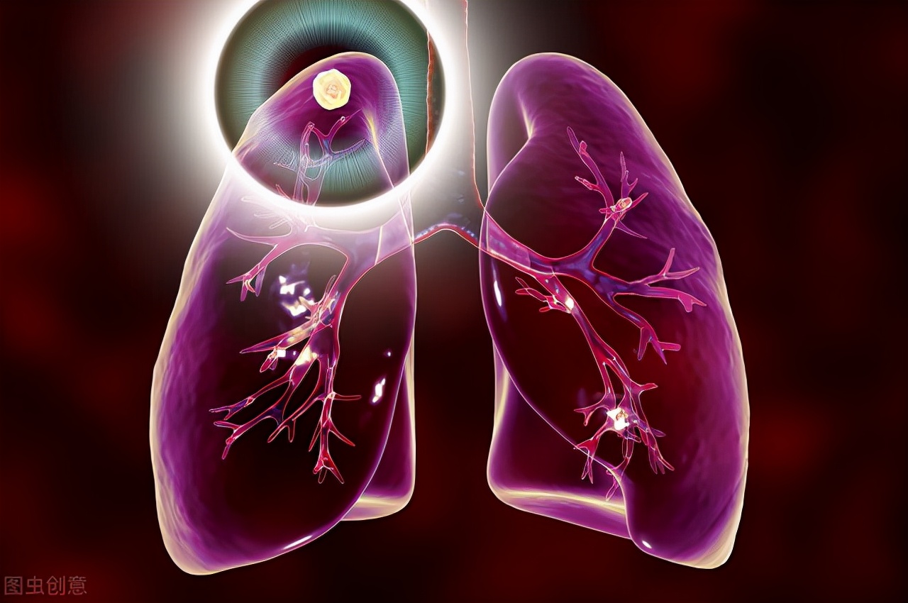 中医肺部小结节怎么消除,消除肺部小结节的锻炼方法