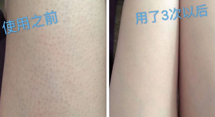 沐浴露推荐学生党秋冬,十大公认最好用的沐浴露秋冬季