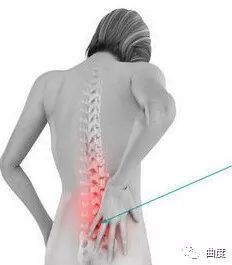 腰间盘突出保守治疗有效果吗,腰间盘突出保守治疗一般住院费用