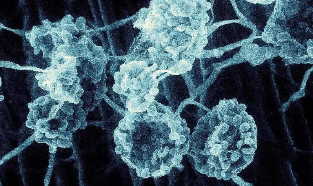 食品厂霉菌及孢子如何杀灭,食品霉菌超标怎么解决