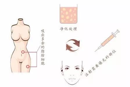 就因为这四个部位,别人像15而你像45