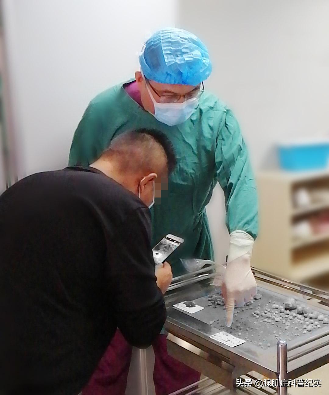 长了八个子宫肌瘤微创手术全过程,子宫粘膜下肌瘤的保宫手术