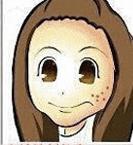 脸上老是长痘怎么祛痘,28岁了脸上老是长痘痘怎么办