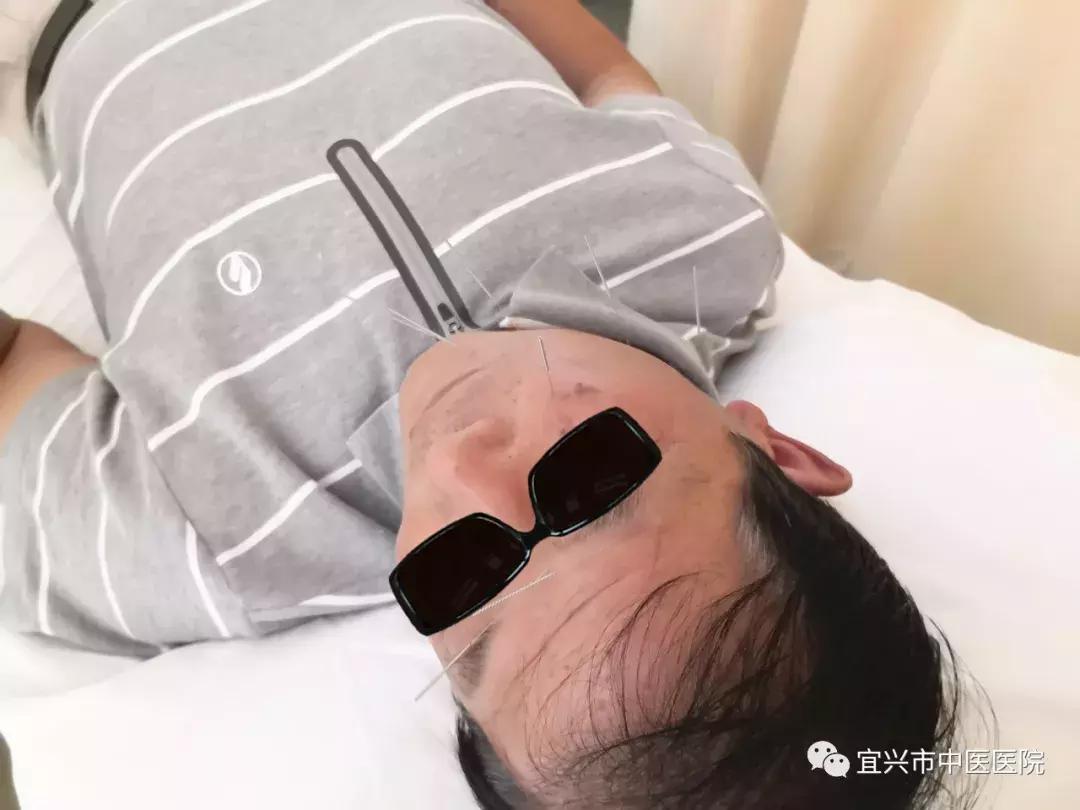 宜兴中医院有治疗面瘫的专家吗,宜兴哪里治面瘫好