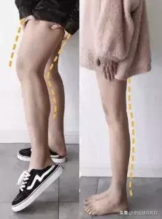 两只腿不一样粗什么原因,一腿粗一腿细是什么原因