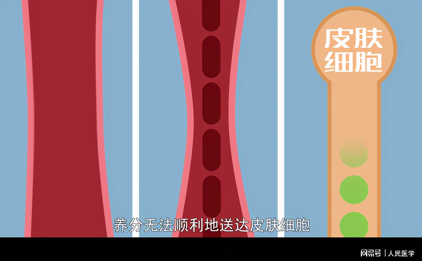 脸上出现像针孔大小的坑,脸上有很多像毛孔一样的坑怎么办