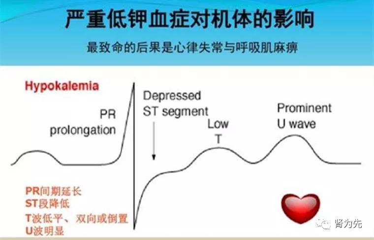 血钾高对肾脏有什么影响,血钾升高对肾功能有影响吗