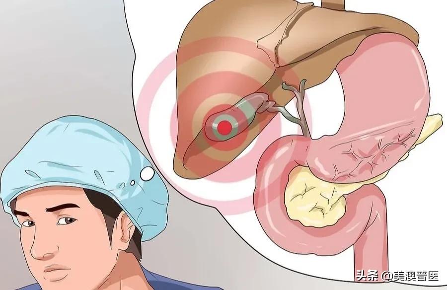 肚子左右两侧疼是肠胃问题吗,肠胃哪些问题会引发肚子疼