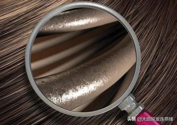 夏天紫外线强头发需要护理,头经常晒太阳脱发怎么预防