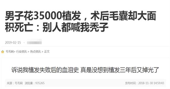 2.5亿脱发人口造就百亿植发生意，不过，动刀的可能是3天速成医师