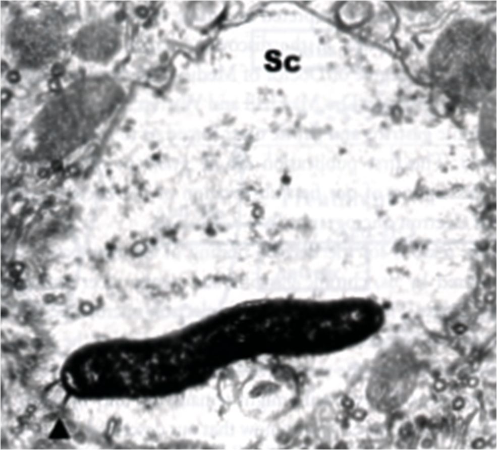 碳13幽门螺杆菌检测结果阳性,幽门螺杆菌阳性要不要治疗