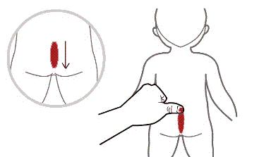 孩子又积食了，孩子一直积食怎么办？