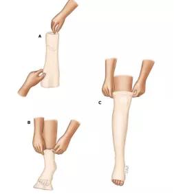 压力袜瘦腿袜真的有用吗,加压袜的功效与作用