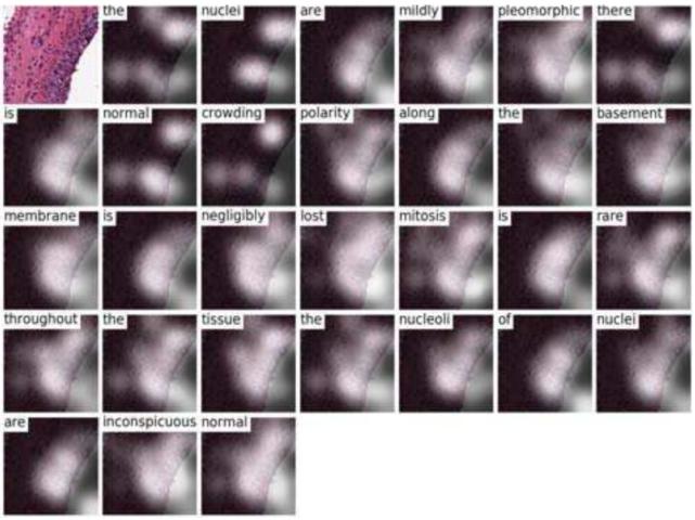 浅谈医学影像学习与实践,基于深度学习的医学影像研究思路
