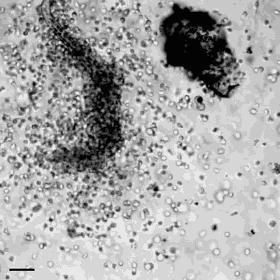 银子用什么方法能洗白,银子杀菌