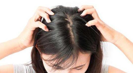 头发上有雪花状头屑用什么洗发水,头屑多的像下雪怎么洗