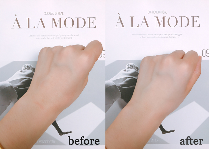 激光修复疤痕皮肤色差,ps如何调整皮肤色差