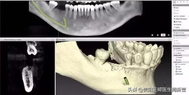 牙疼去看牙需要多久,牙疼的建议