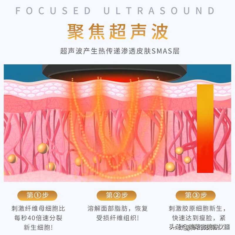 面部v雕仪器的功效原理