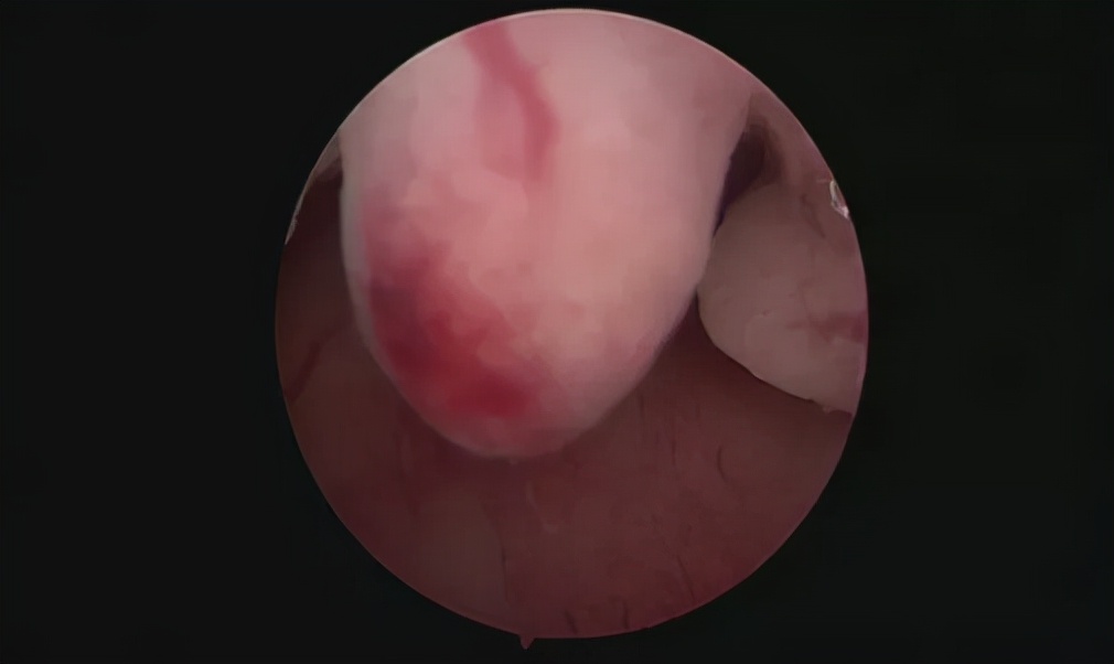 女性做amh检查要注意什么,女性检查必做项目以及时间