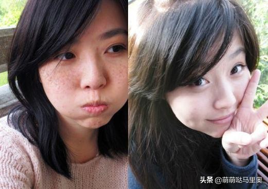 维生素e既能吃也能抹吗,维生素e片可以敷脸吗有什么功效