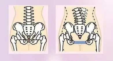 产妇用束缚带有什么效果,束缚带产后产妇如何使用