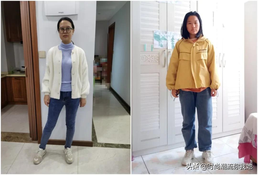 单眼皮凸嘴素人改造,肿眼泡整容成功案例