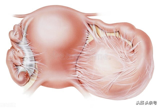盆腔炎病原体及其致病特点
