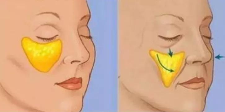 脸发腮的解决方法图解,如何改善发腮或避免发腮