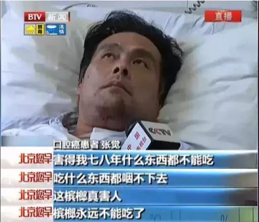 因为吃槟榔而被割掉牙床,嚼槟榔被割掉嘴巴的有多少人了