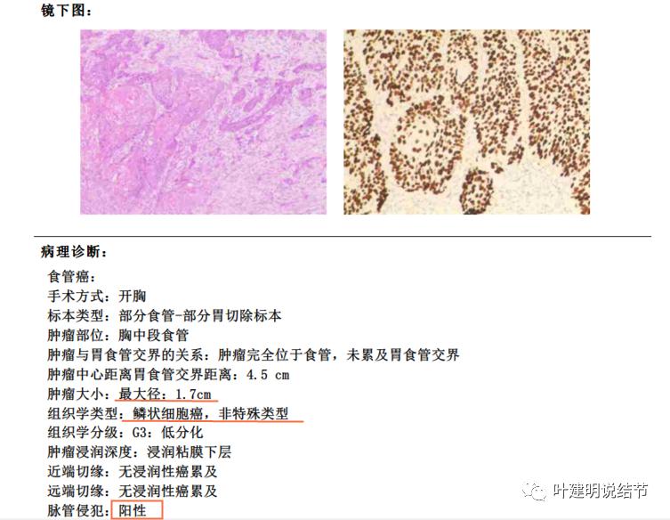 同时患结肠癌和直肠癌怎么办,同时查出了胃癌和肺癌怎么办