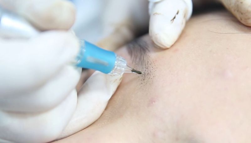 纹眉失败像什么,纹眉掉痂了眉毛怎么是红色