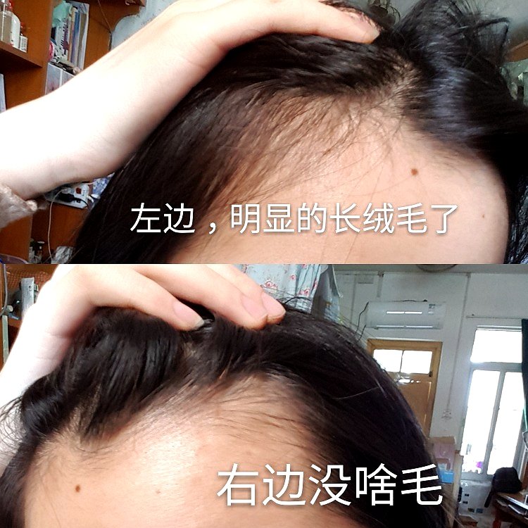 脱发洗发水测评红黑榜,霸王育发防脱洗发水生发套装468ml