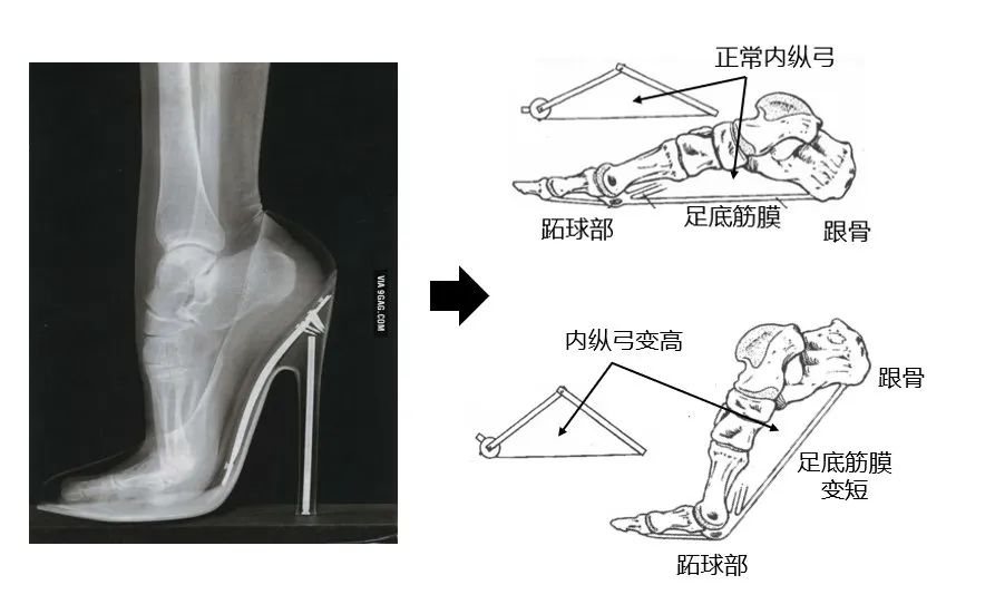 为了美,你愿意上麻药穿红色高跟鞋吗?