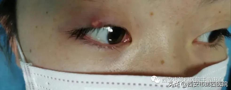 健康科普探访,健康科普浅析疾病复发