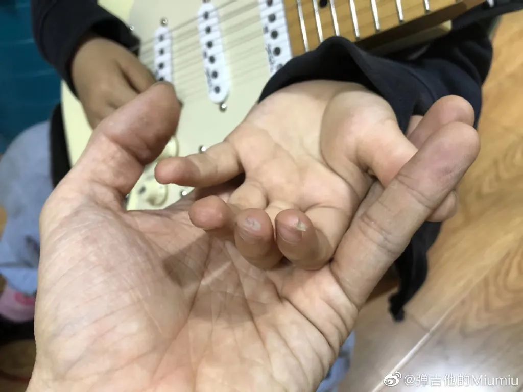 6岁小女孩手上全是血泡老茧：哪来的一夜成名，还不是百炼成钢