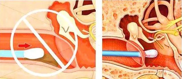 摄像头掏耳勺app,无线高清掏耳勺挖耳神器带摄像头