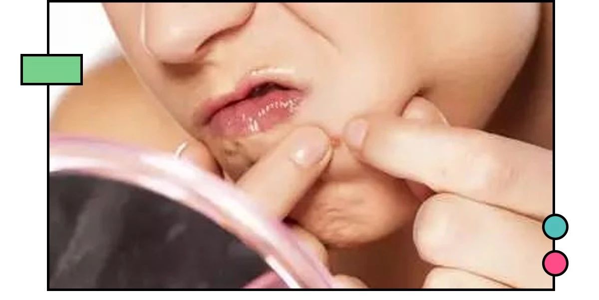 如何祛痘印?看了这篇能解决你大部分的问题!