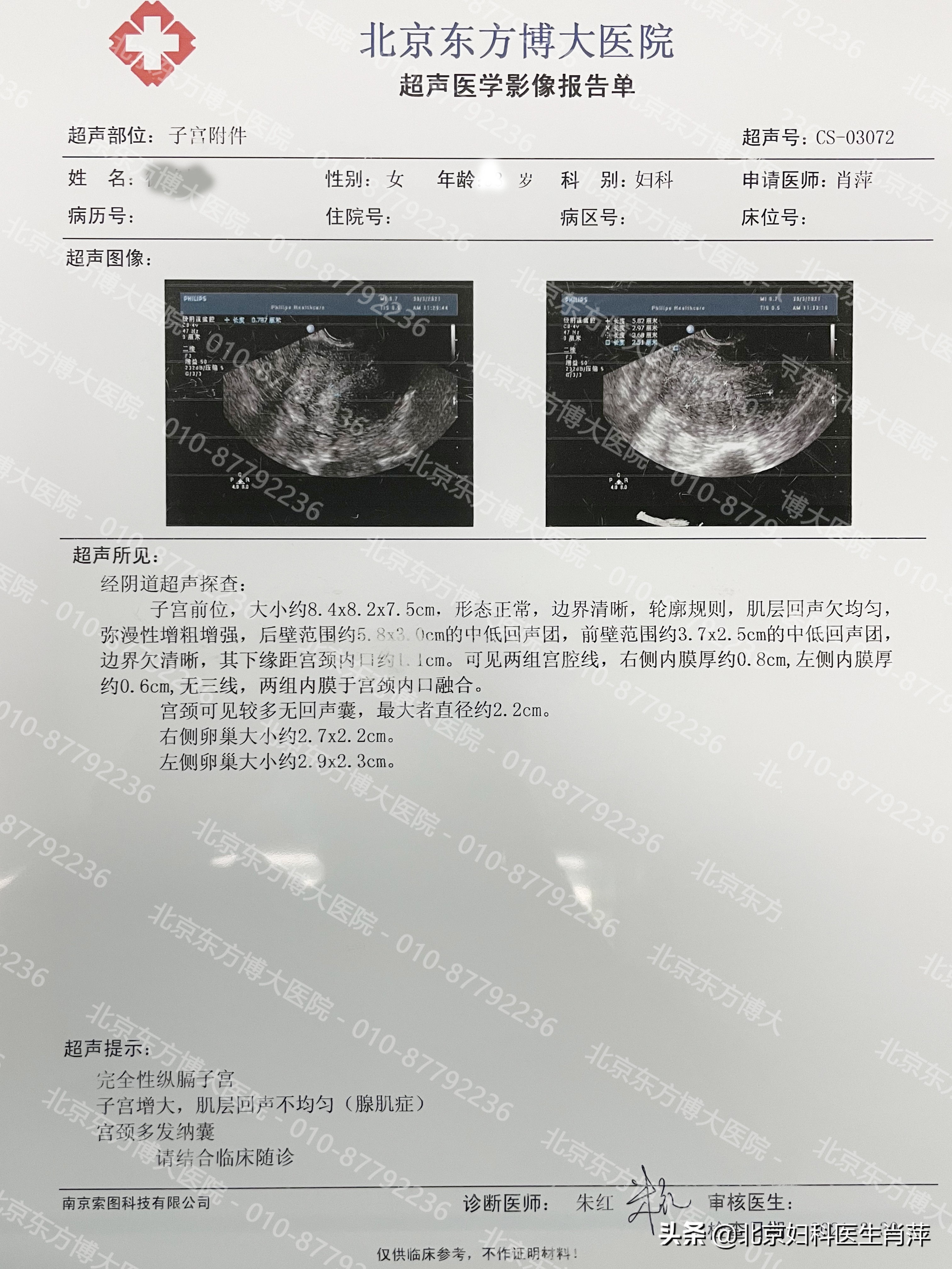 子宫腺肌症中医叫什么,得了子宫腺肌症怎么治好