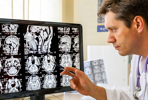 大脑是人体司令部,出现脑癌常会引起头痛等异常,该如何正确应对