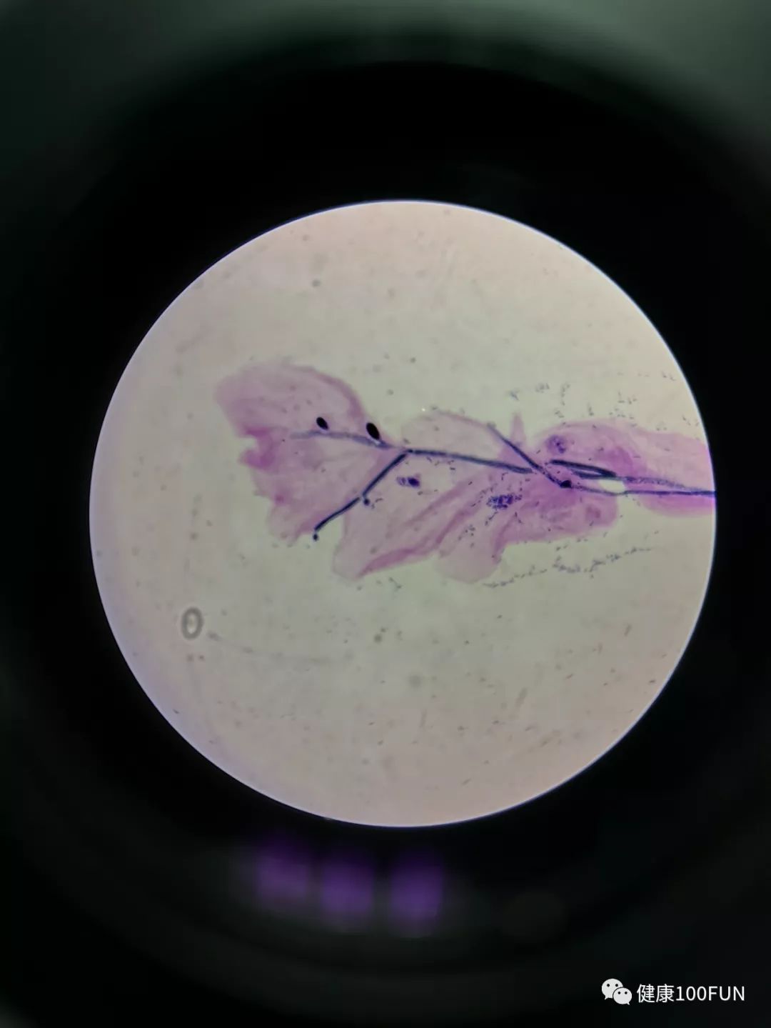 女人那个地方痒是怎么了,女性哪里痒