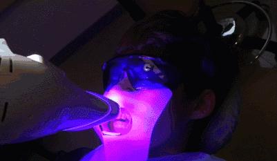 智齿蛀牙痛有什么有效方法止痛,智齿旁边牙松动蛀牙如何处理