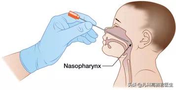 孩子反复肺炎支原体感染怎么办,孩子肺炎支原体反复感染怎么办