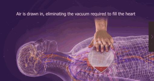 cpr心肺复苏术胸外按压和人工呼吸,心肺复苏术操作步骤有cpr吗