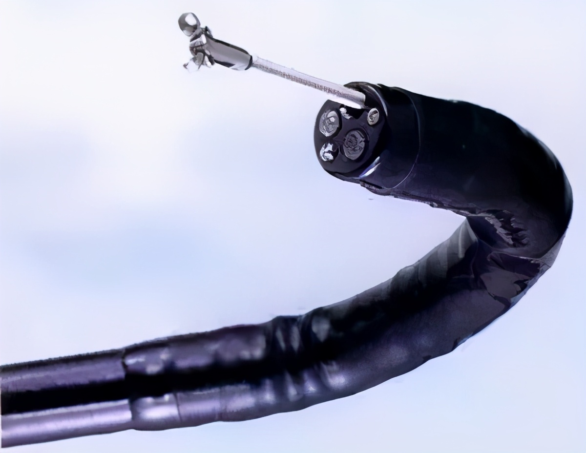 肠镜检查预防什么病,哪些肠镜结果需重视