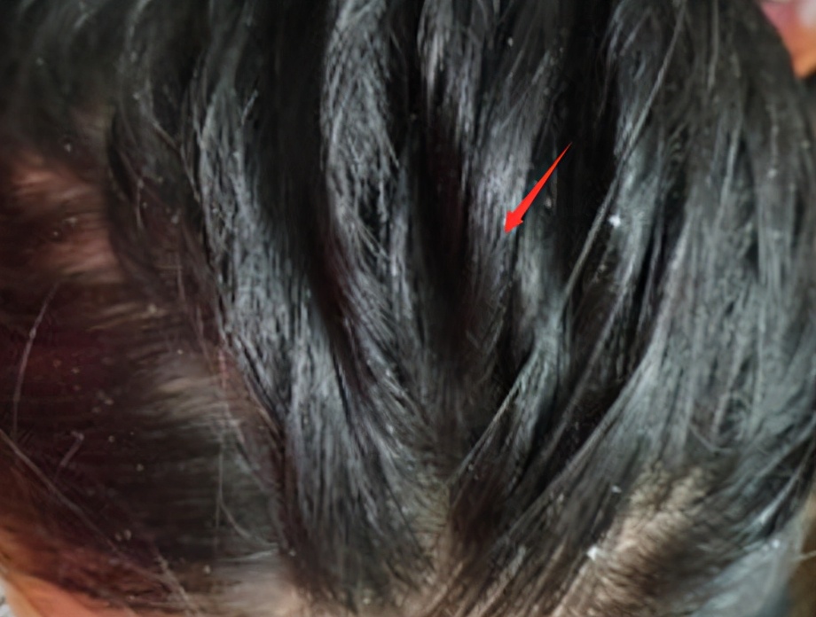 怎么判断是油性头发还是干性头发,怎么知道自己是油性头发还是干性